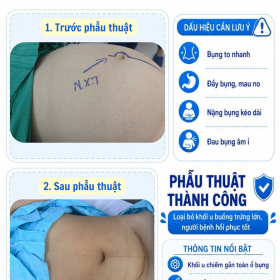 Bung to bat thuong 1