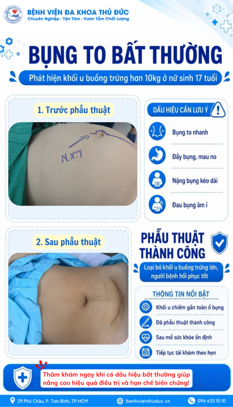 Bung to bat thuong 1