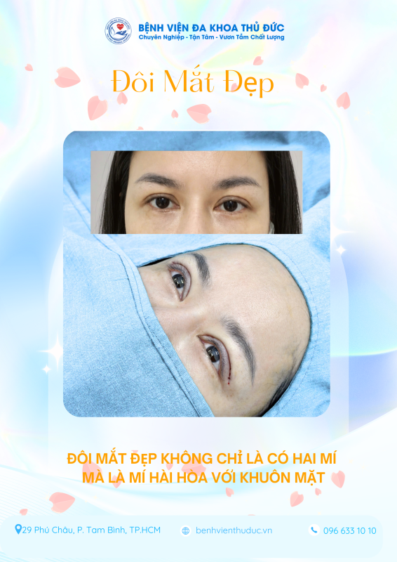 Cắt tạo hình mắt hai mí – Cá thể hóa vẻ đẹp tự nhiên 1 doi mat dep
