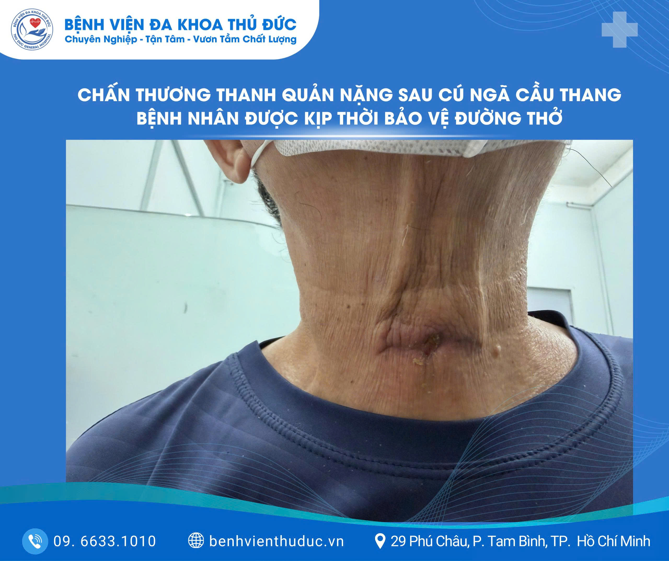 chan thuong thanh quan nang sau cu nga cau thang benh nhan duoc kip thoi bao ve duong tho 2