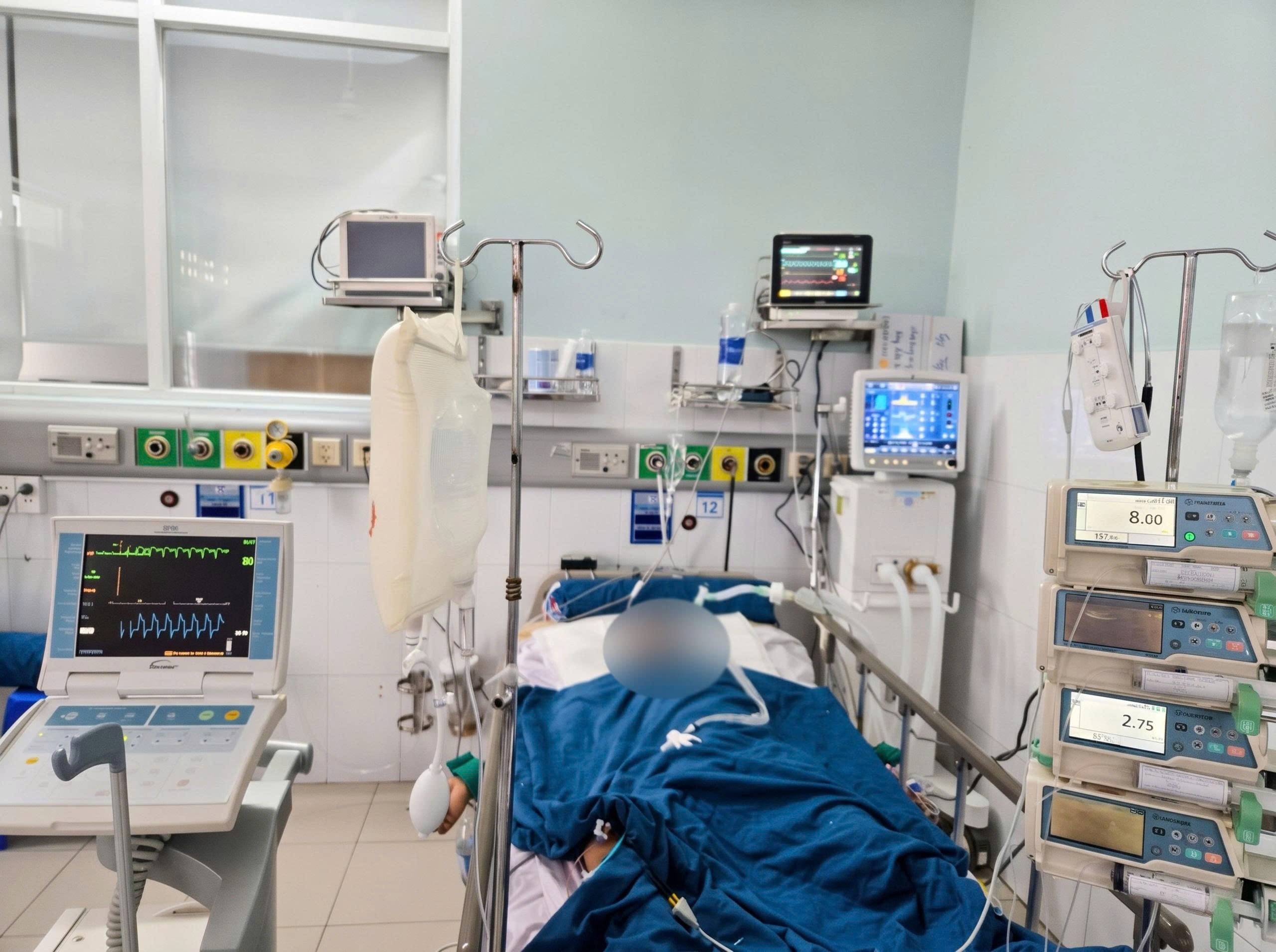 HAI LẦN NÍN THỞ GIÀNH GIẬT SỰ SỐNG CHO BỆNH NHÂN NHỒI MÁU CƠ TIM NGƯNG TIM 30 PHÚT